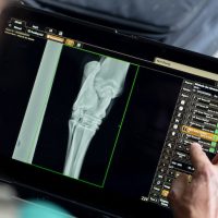Radiographie